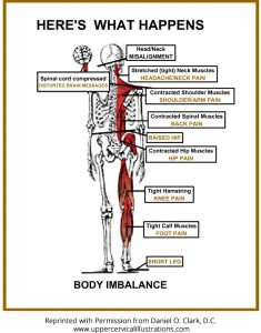 Body Imbalance